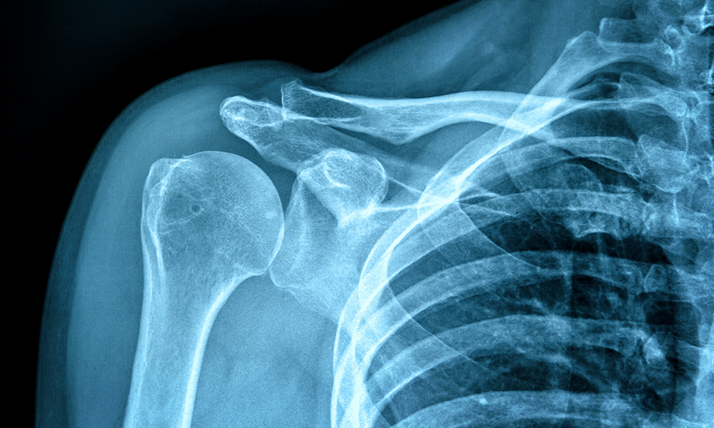 The latest research is supported at the SPIE Medical Imaging event