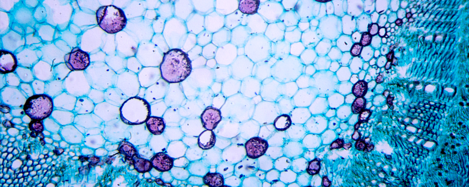 Microscopic view of cells showing various cell structures stained in purple and blue hues.