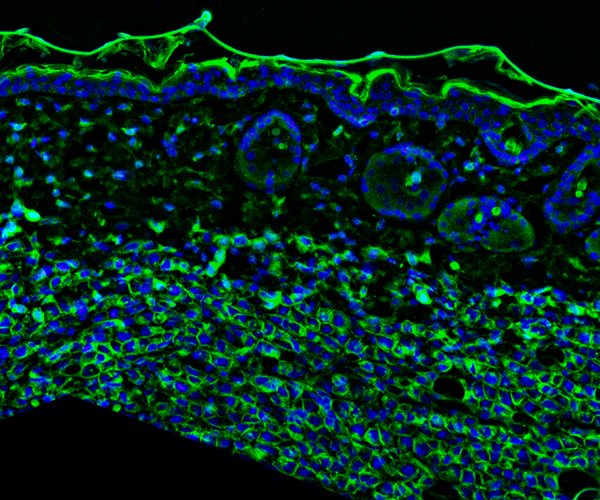 Fluorescent microscopy image showing a cross-section of tissue with green and blue staining. The green areas form a network-like pattern and represent the cell membranes and structures. The blue areas are scattered throughout, representing the locations of the cell nuclei.