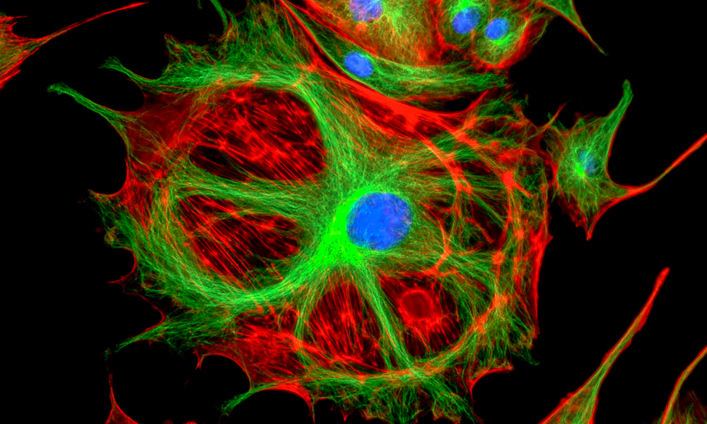 Fluorescence microscopy image showing several cells on a black background, with branching red and green filament-like structures forming the cell bodies and bright blue circular nuclei at the center of each cell. The red and green networks overlap and radiate outward, creating web-like patterns around the blue nuclei.