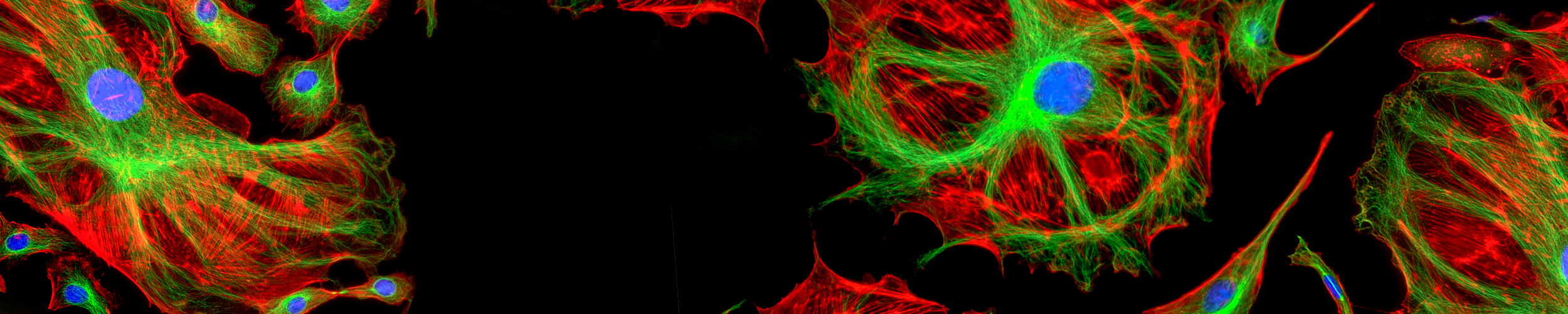 Fluorescence microscopy image showing several cells on a black background, with branching red and green filament-like structures forming the cell bodies and bright blue circular nuclei at the center of each cell. The red and green networks overlap and radiate outward, creating web-like patterns around the blue nuclei.