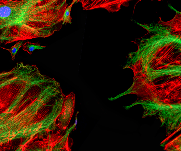 Fluorescence microscopy image showing several cells on a black background, with branching red and green filament-like structures forming the cell bodies and bright blue circular nuclei at the center of each cell. The red and green networks overlap and radiate outward, creating web-like patterns around the blue nuclei.