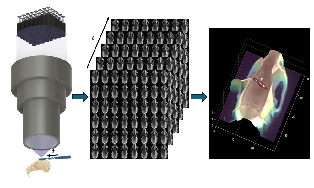 FiLM-Scope simultaneously captures 48 multiperspective images of a surgical scene