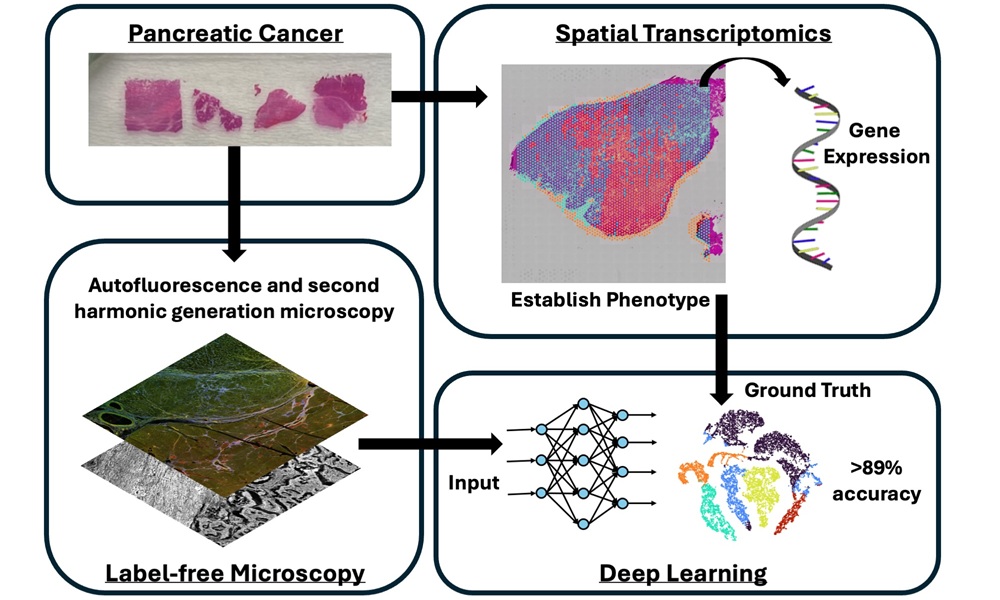 Researchers have developed a new method for pancreatic cancer phenotyping using label-free optical microscopy coupled with a deep learning artificial intelligence algorithm.