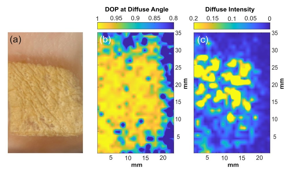 Polarimetric measurements of terahertz scattering can detect subtle changes in tissue architecture that result from disease or damage.