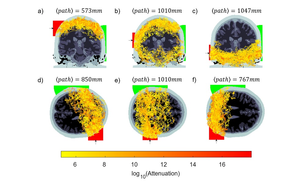 Detecting photons through an entire adult head explores the limits of photon transport in the brain, for access to regions of the brain currently inaccessible with noninvasive optical brain imaging