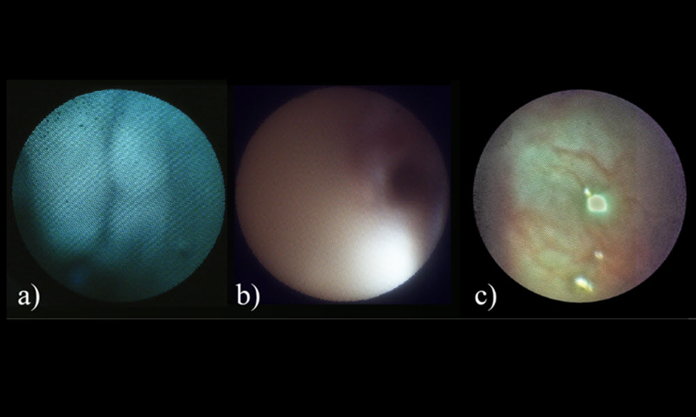 Three circular medical images are displayed side by side on a black background, each representing a different endoscopic view of internal tissue and labeled “a,” “b,” and “c” in white text beneath the images
