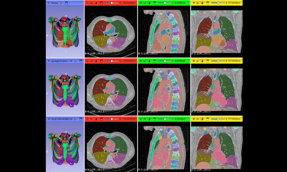 Grid of medical imaging segmentation results showing CT scans of chest and abdomen with color‑coded organs and tissues compared across multiple model outputs.