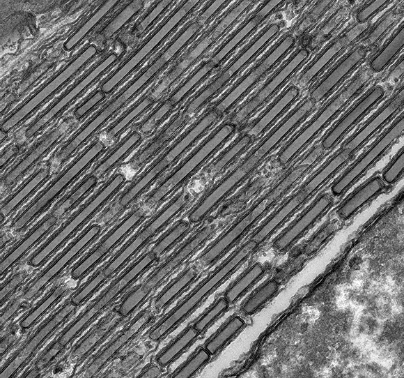 iridocytes