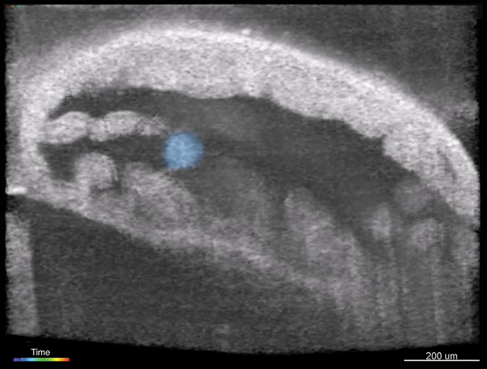 Intravital OCT reveals an embryo&mdash; before implantation&mdash;travelling through a fallopian tube of a mouse