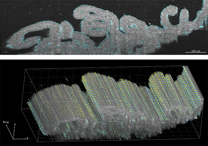 Cilia in human fallopian tubes
