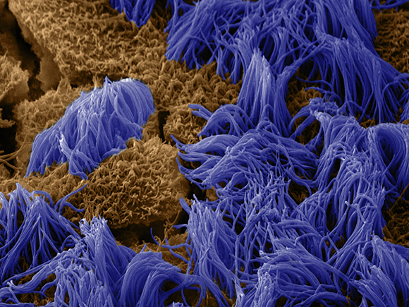 SEM image showing human ciliated cells inside Emulate’s lung-chip