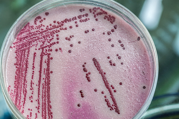 Legionella-bacterium